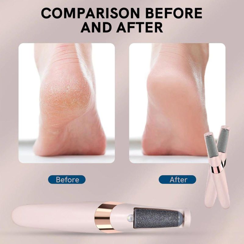 Smooth Feet Electric Callus Remover