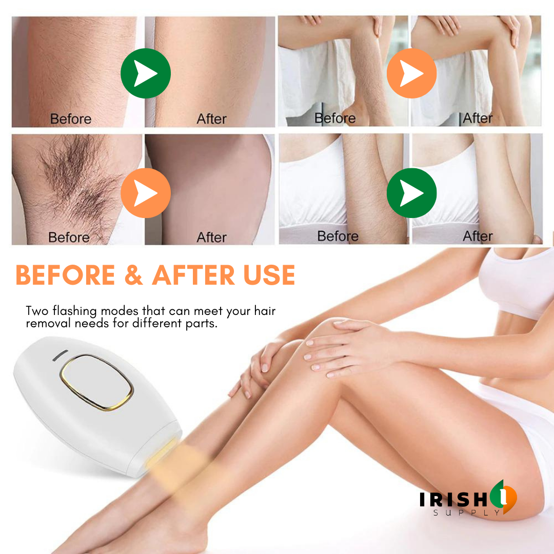 Home IPL Hair Removal Solution