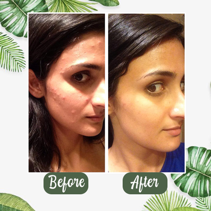 Green Tea Pore Purifying Mask